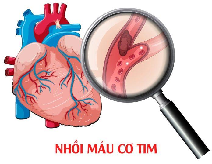 rối loạn nhịp tim