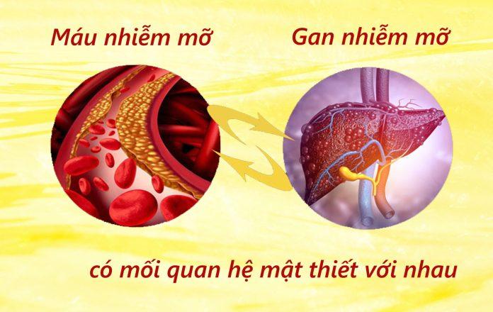 Những Điều Quan Trọng Về Bệnh Mỡ Máu Bạn Cần Biết